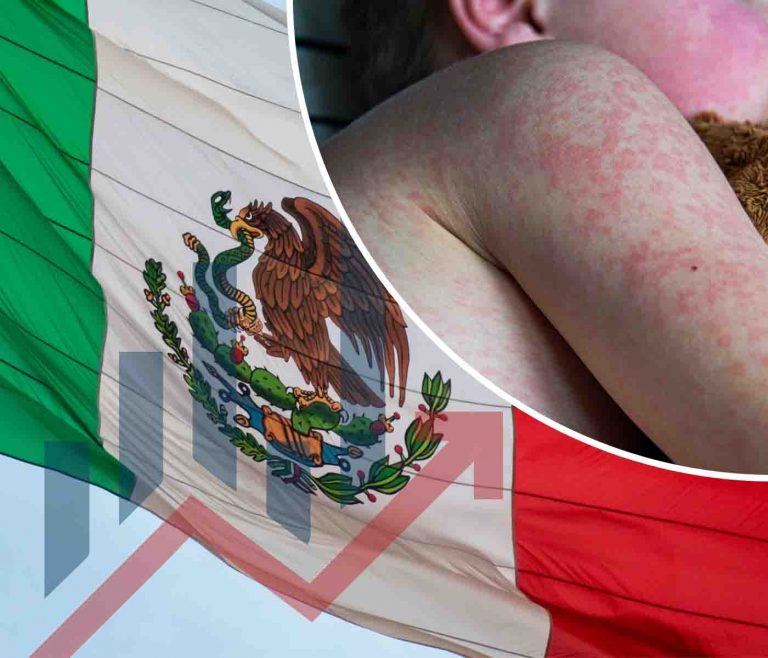 Sarampión en México: 34 muertes y más de 12,000 contagios