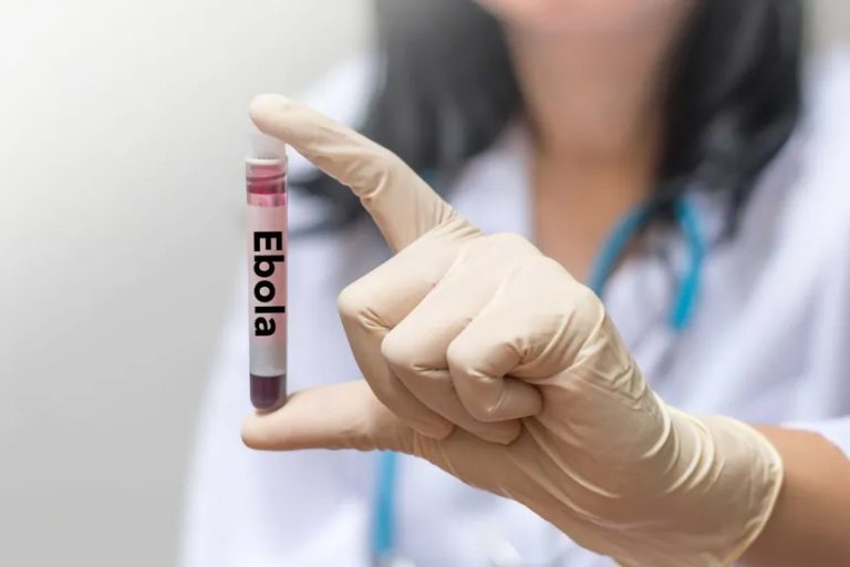 OMS reconoce que el brote  de ébola sigue sin control