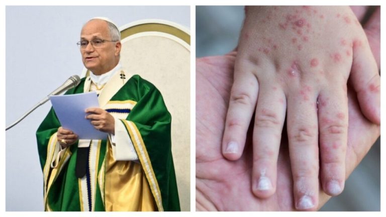 Alto riesgo de propagación sarampión ante visita del Papa a Sudamérica